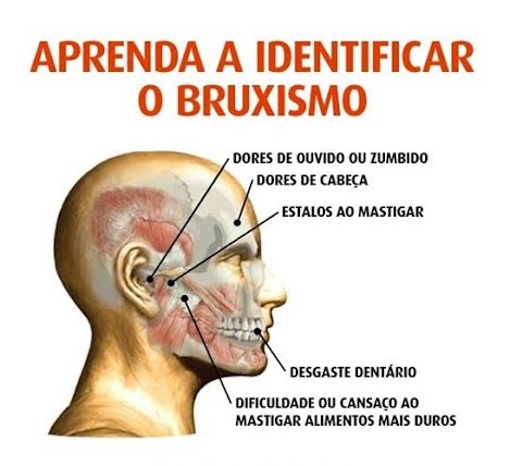 O Bruxismo tem cura?